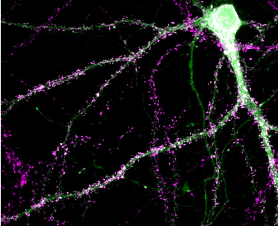 Fluorescent neuron