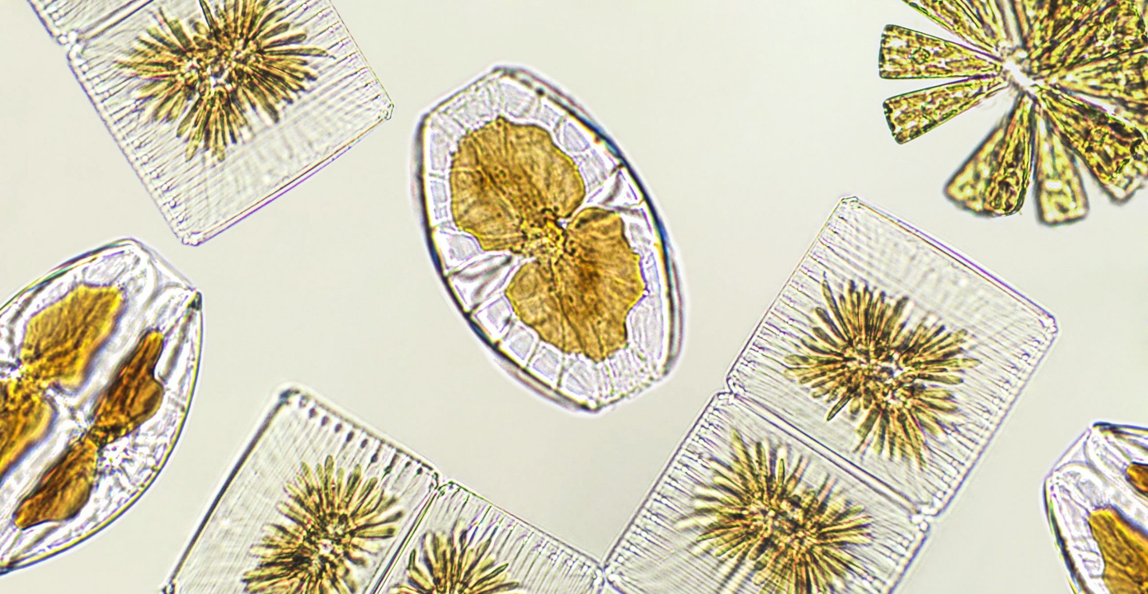 Diatoms under the microscope.