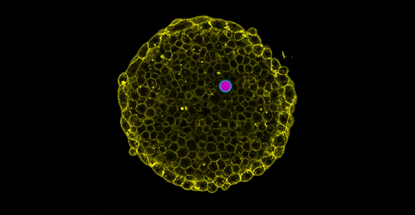a pink-colored droplet between yellow-bordered cells