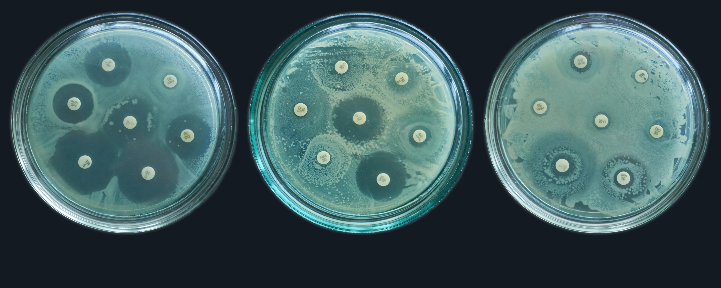 three blue-gray petri dishes against a black background testing the resistance of bacteria to antimicrobials