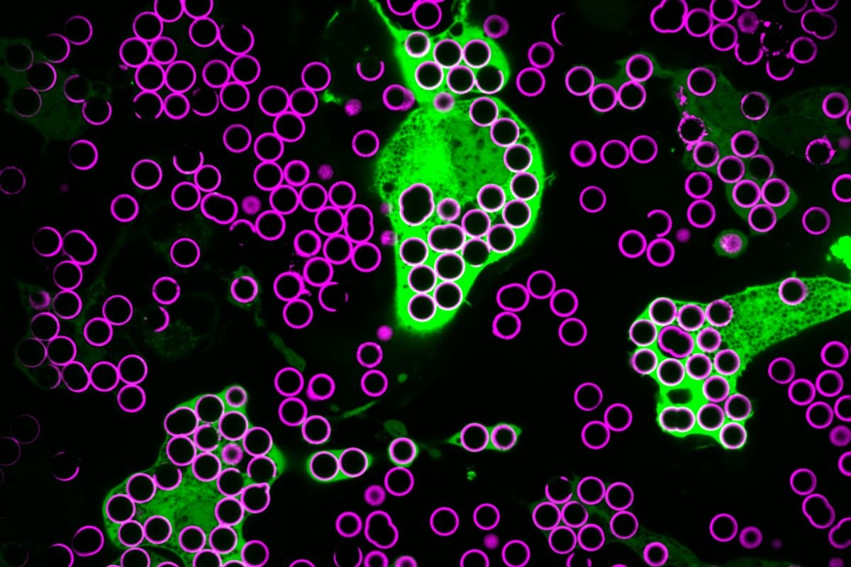 Macrophages (in green) engulf IgG-coated beads (in magenta).