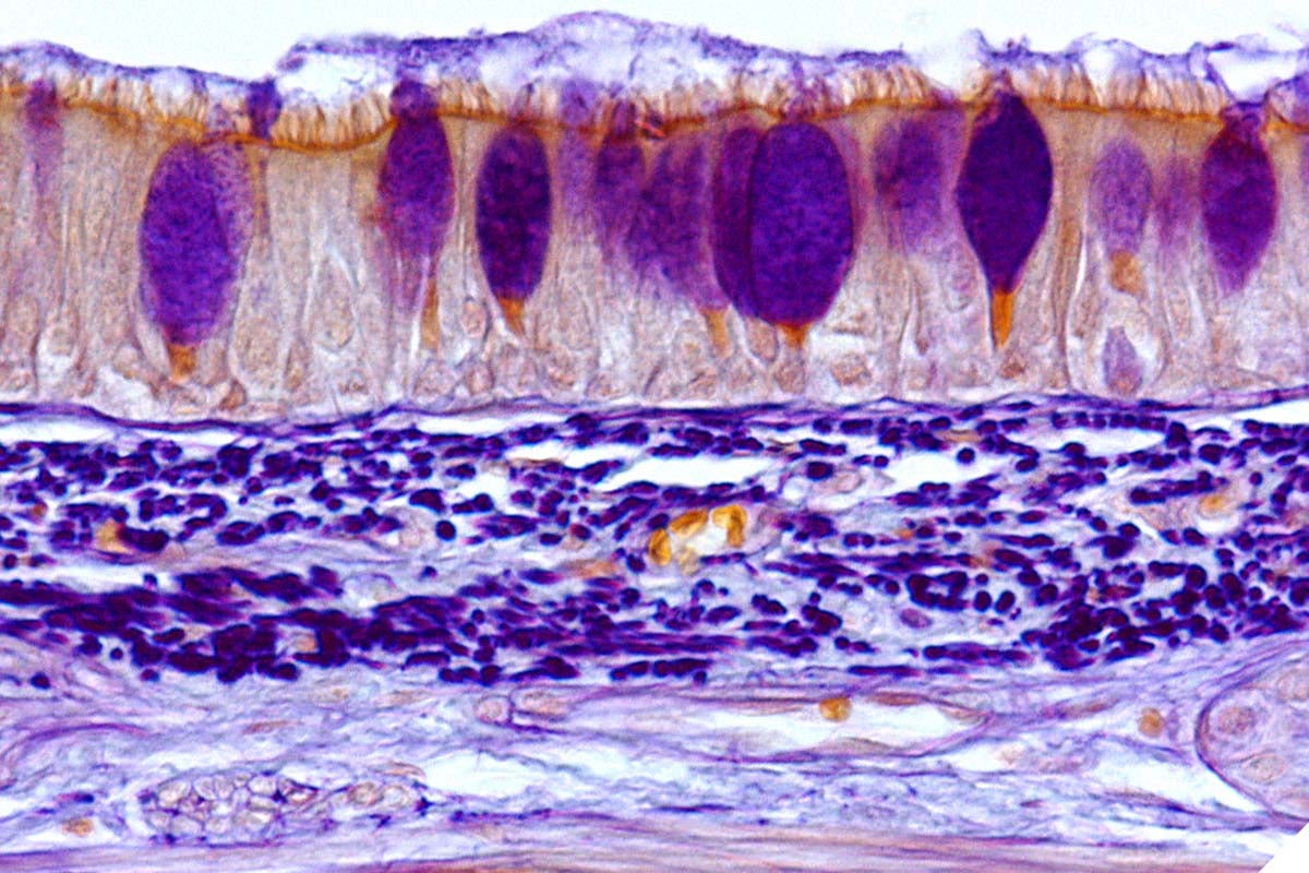 呼吸器感染症治療につながる古いタンパク質の再評価（A New Look at an Old Protein May Yield Therapy for Contagious Respiratory Disease）